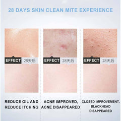 Dr.Rashel Hyaluronic Acid Essence Cleansing Mousse - 125ml - Dr-Rashel-Official